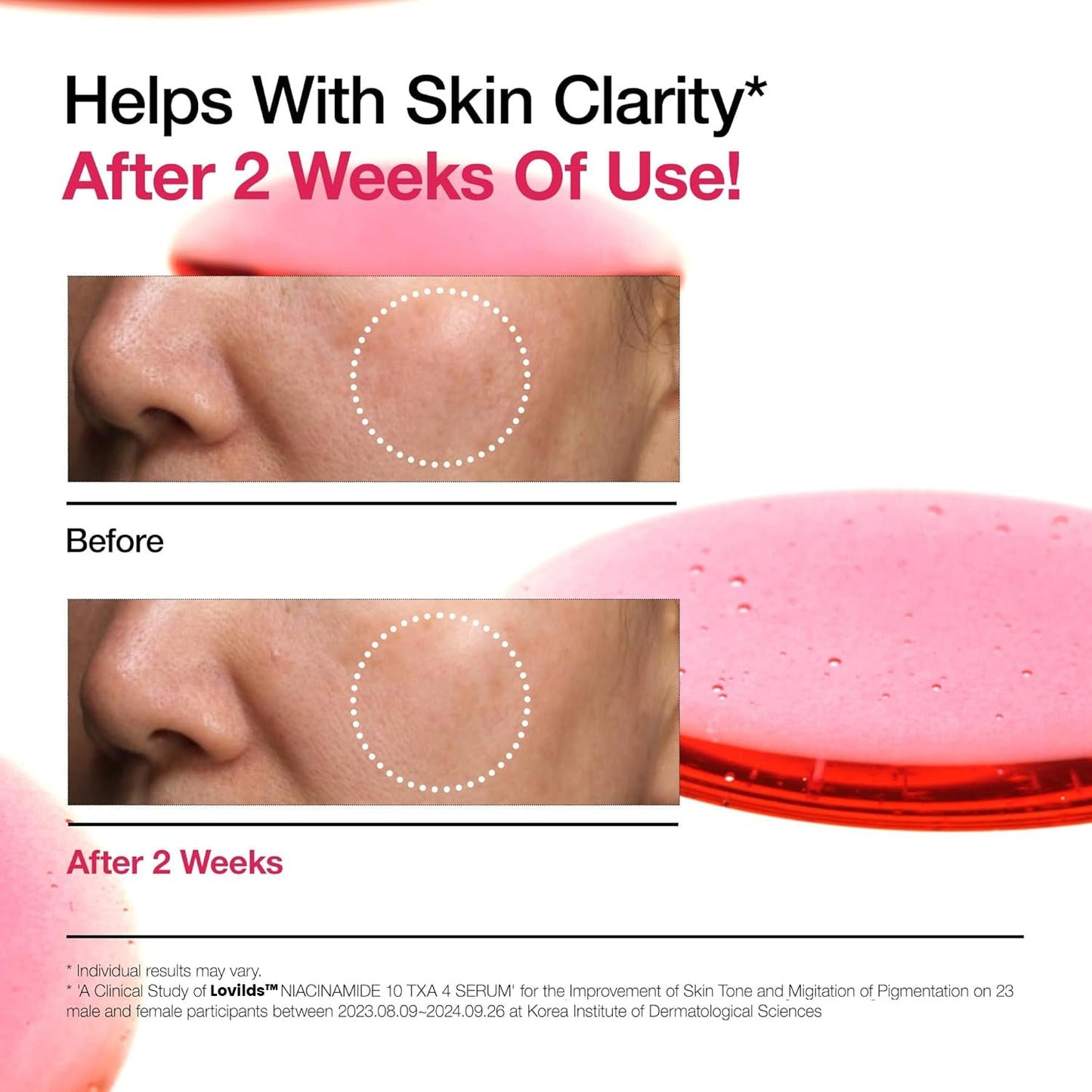 Final 3 Hours:70% OFF🔥 Lovilds™ 10% Niacinamide+ 4% Tranexamic Acid Serum