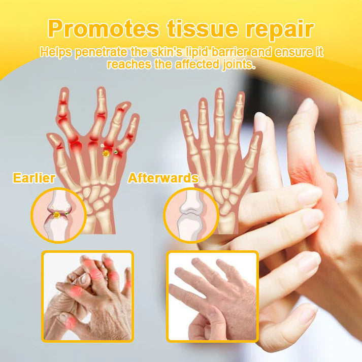 AQA™ Botulinum Toxin & Bee Essence Pain-Relief Bone Healing Cream