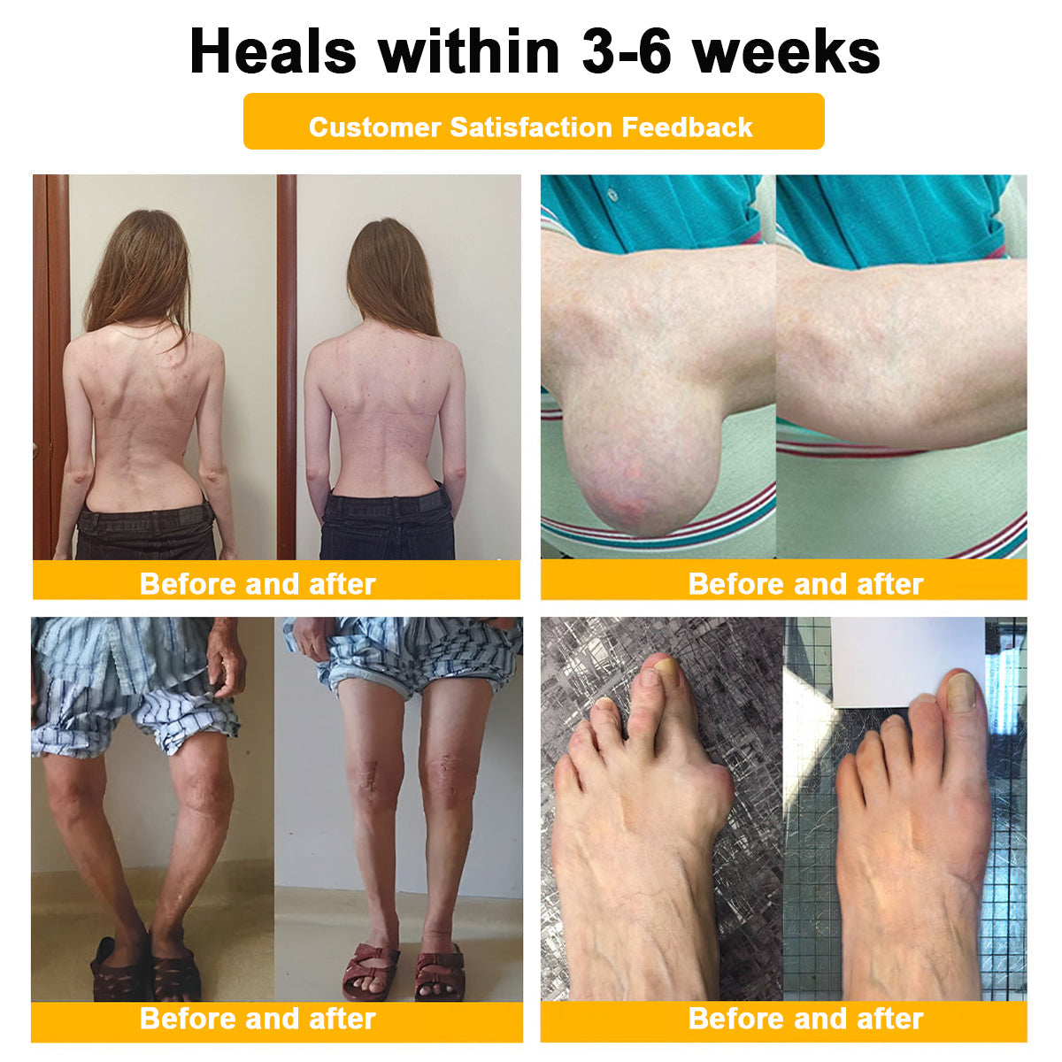 AQA™ Botulinum Toxin & Bee Essence Pain-Relief Bone Healing Cream