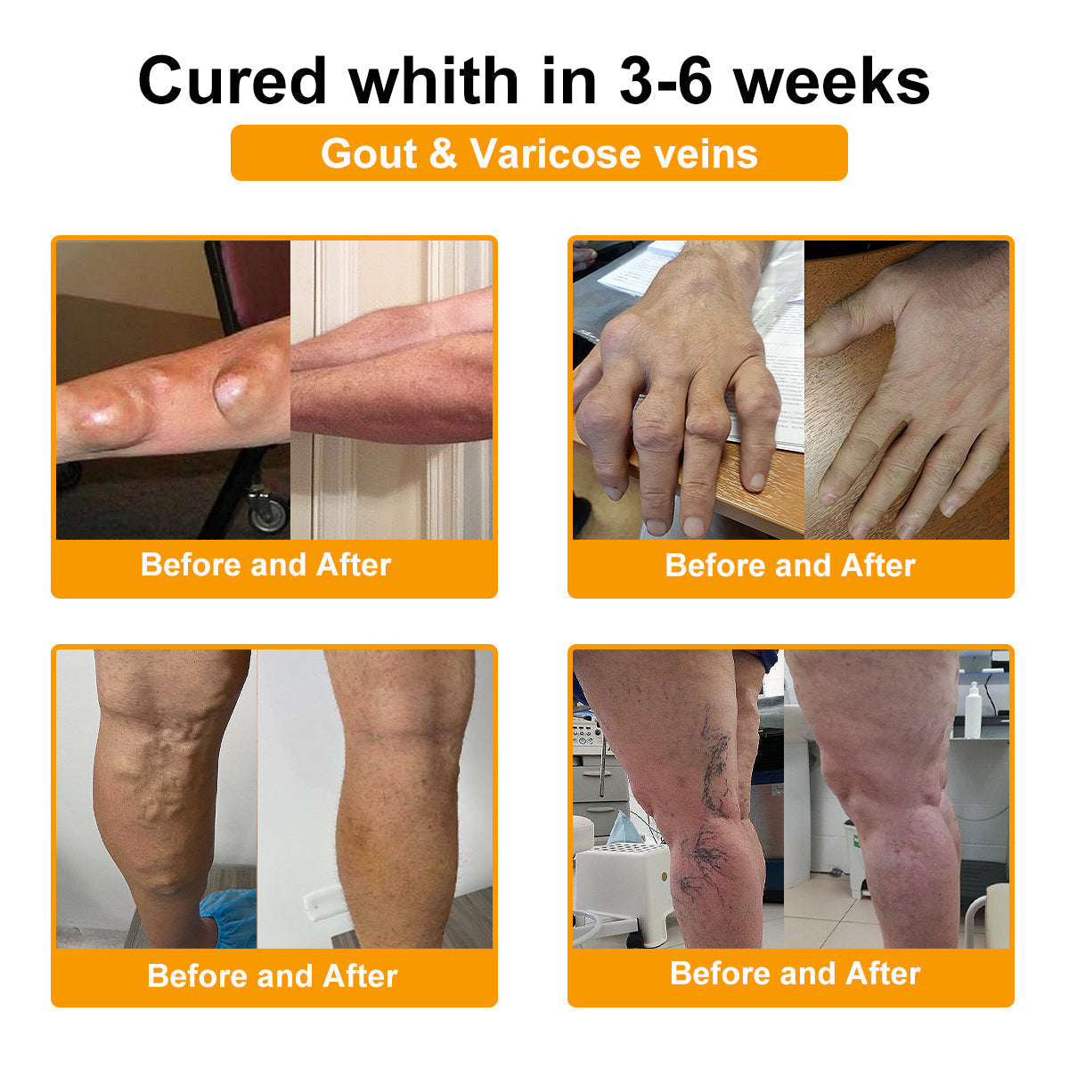 AQA™ Botulinum Toxin & Bee Essence Pain-Relief Bone Healing Cream