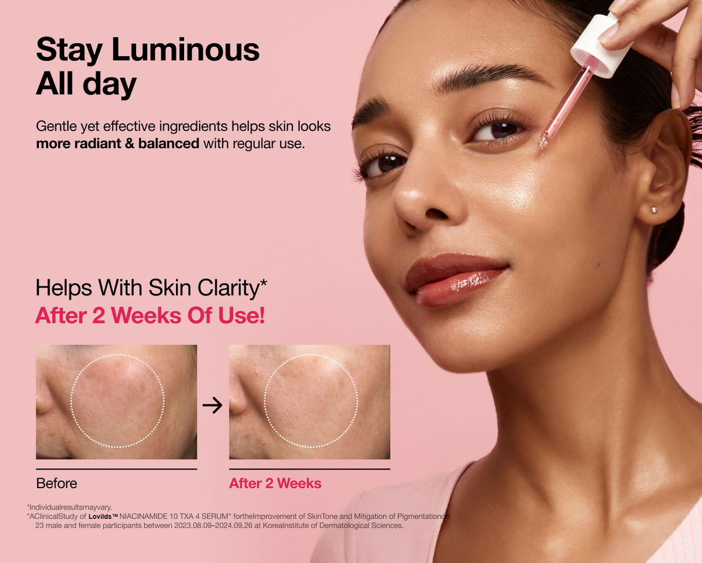 Final 3 Hours:70% OFF🔥 Lovilds™ 10% Niacinamide+ 4% Tranexamic Acid Serum