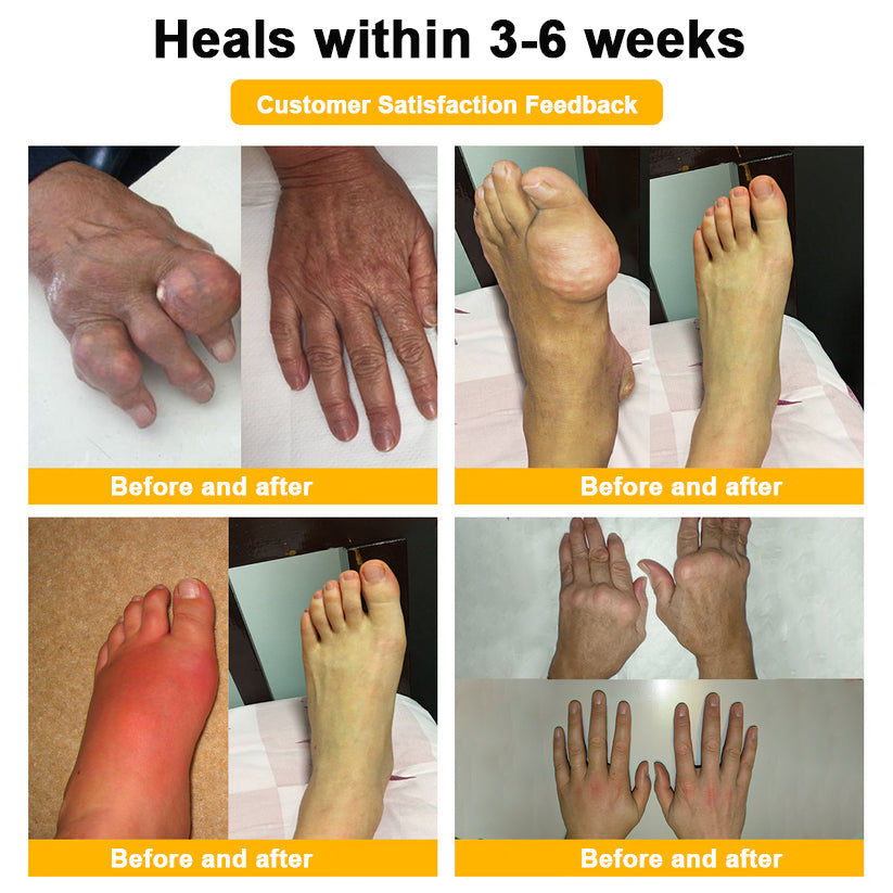 AQA™ Botulinum Toxin & Bee Essence Pain-Relief Bone Healing Cream