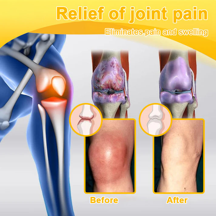 AQA™ Botulinum Toxin & Bee Essence Pain-Relief Bone Healing Cream
