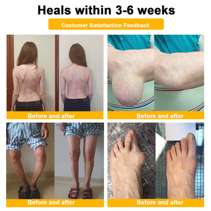 AQA™ Botulinum Toxin & Bee Essence Pain-Relief Bone Healing Cream